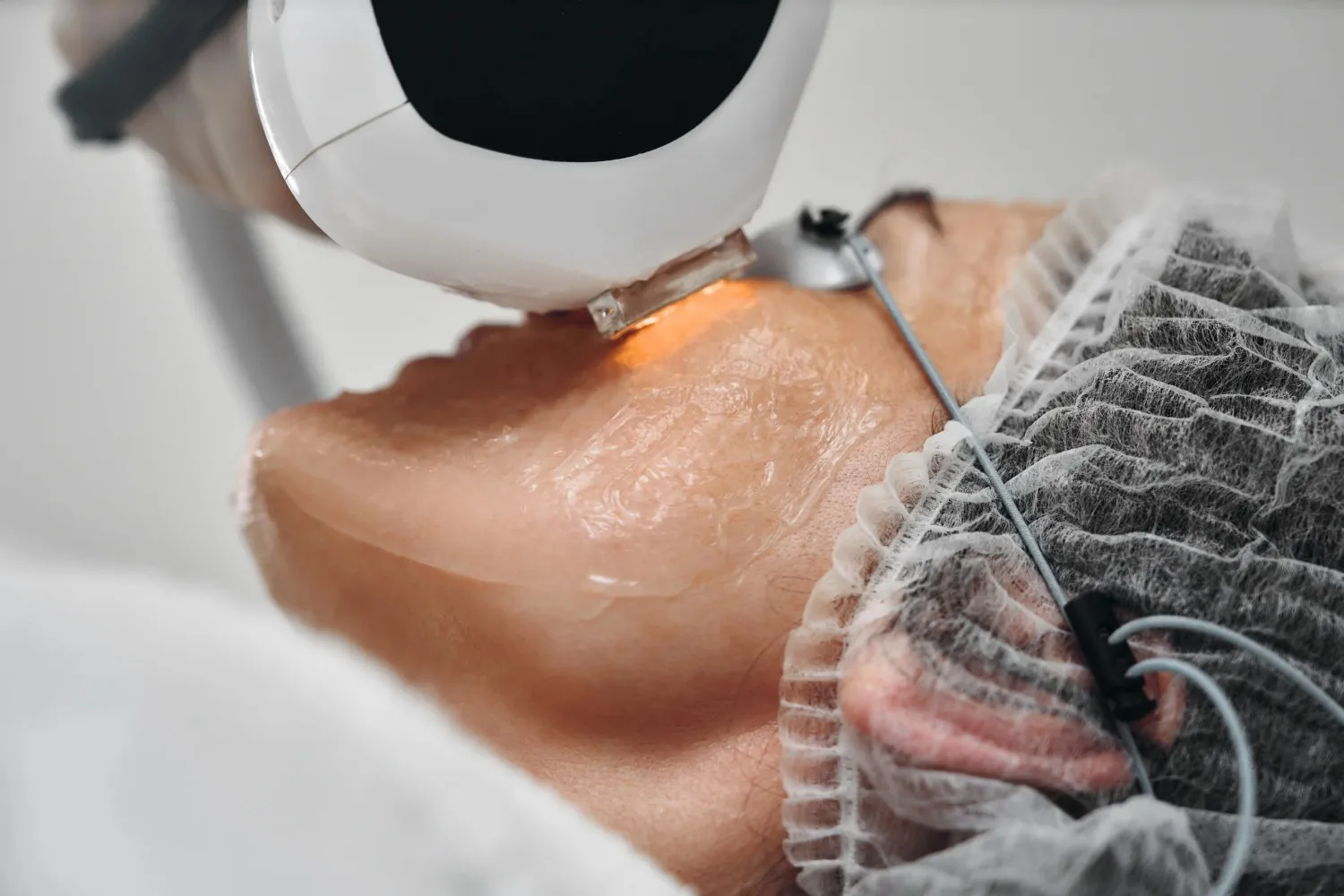 How BBL Therapy Works Understanding the Technology and Process in Flower Mound, TX at SpaVela